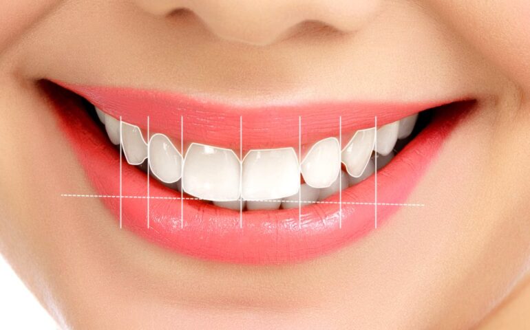 Smile design creates a natural smile with aesthetic teeth and gums, tailored to patient needs and face shape, using whitening, implants, and veneers.